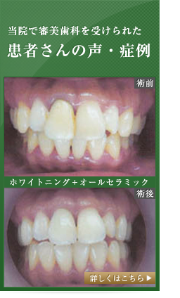 当院で審美歯科を受けられた患者さんの声・症例